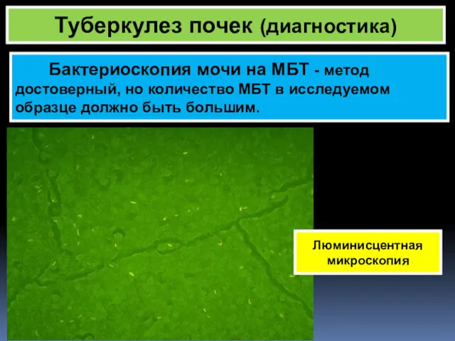 Туберкулез почек (диагностика) Бактериоскопия мочи на МБТ - метод достоверный,