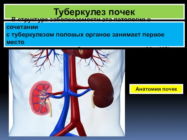 Туберкулез почек Анатомия почек В структуре заболеваемости эта патология в