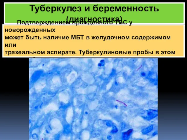 Туберкулез и беременность (диагностика) Подтверждением врожденного ТБС у новорожденных может