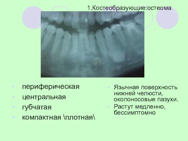 периферическая центральная губчатая компактная \плотная\ Язычная поверхность нижней челюсти, околоносовые пазухи. Растут медленно, бессимптомно 1.Костеобразующие:остеома