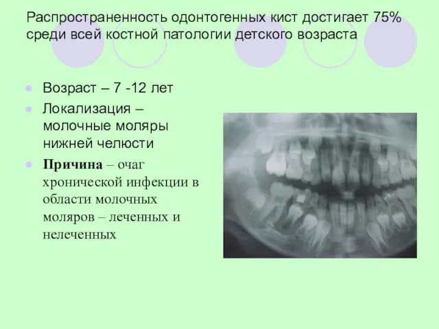 Распространенность одонтогенных кист достигает 75% среди всей костной патологии детского