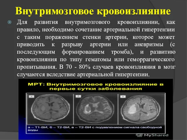 Внутримозговое кровоизлияние Для развития внутримозгового кровоизлиянии, как правило, необходимо сочетание