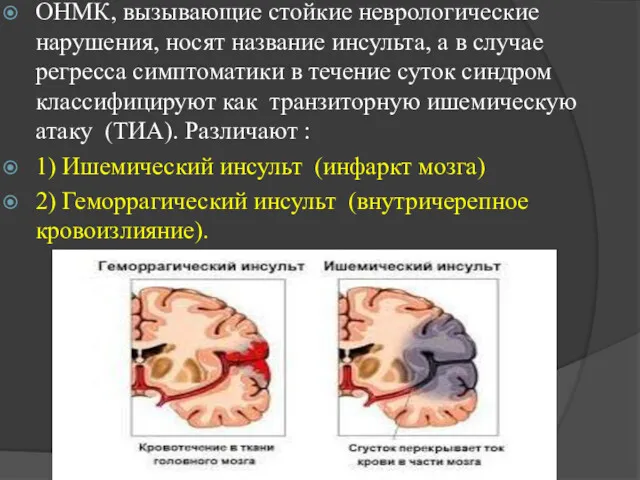 ОНМК, вызывающие стойкие неврологические нарушения, носят название инсульта, а в случае регресса симптоматики