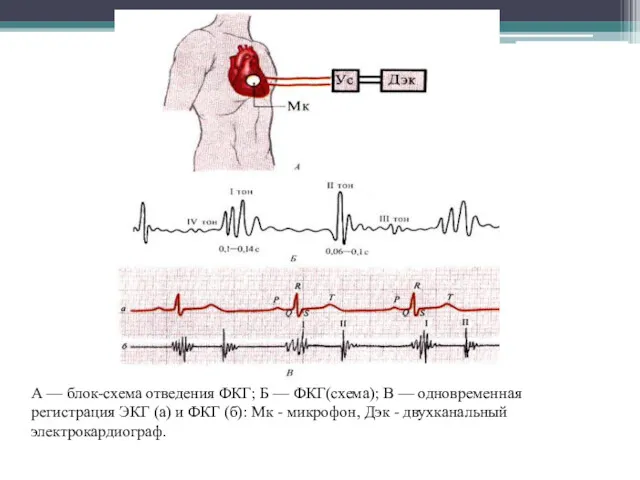 А — блок-схема отведения ФКГ; Б — ФКГ(схема); В —