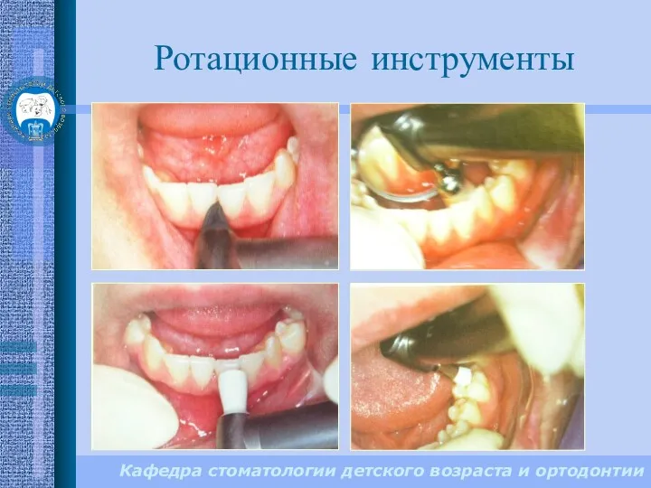 Кафедра стоматологии детского возраста и ортодонтии Ротационные инструменты