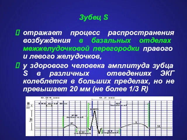 Зубец S отражает процесс распространения возбуждения в базальных отделах межжелудочковой