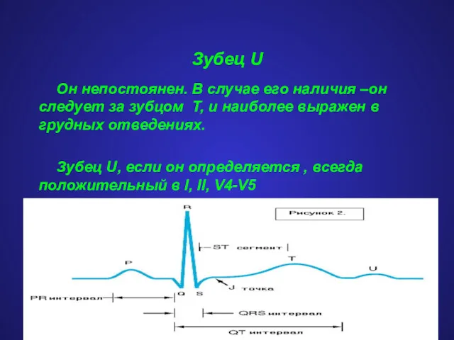 Зубец U Он непостоянен. В случае его наличия –он следует