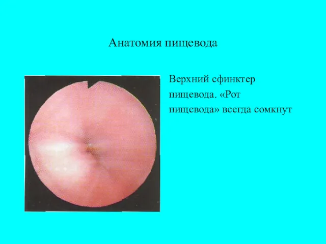 Анатомия пищевода Верхний сфинктер пищевода. «Рот пищевода» всегда сомкнут