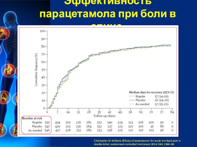 Эффективность парацетамола при боли в спине. Christopher M Williams Efficacy