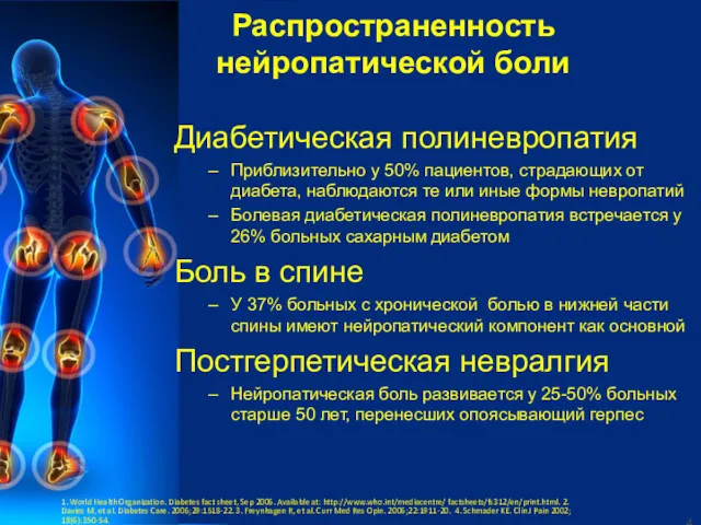 Распространенность нейропатической боли Диабетическая полиневропатия Приблизительно у 50% пациентов, страдающих