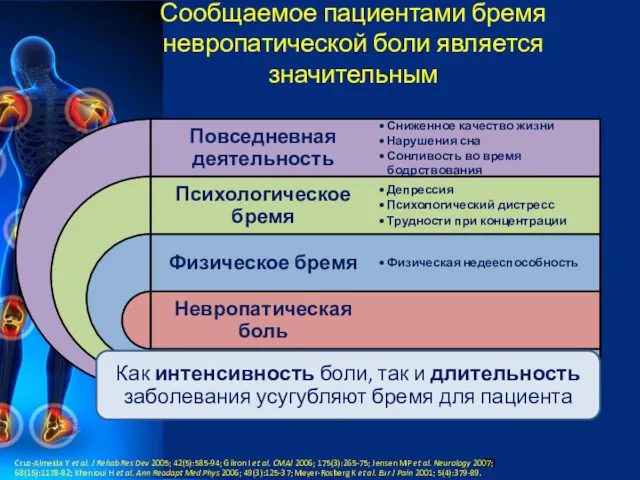 Сообщаемое пациентами бремя невропатической боли является значительным Cruz-Almeida Y et