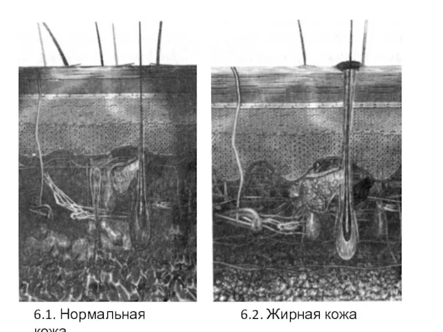 6.1. Нормальная кожа 6.2. Жирная кожа