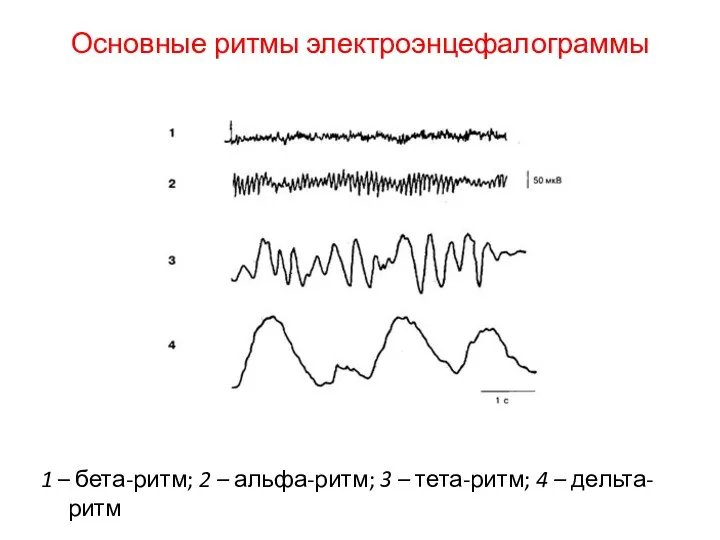 Основные ритмы электроэнцефалограммы 1 – бета-ритм; 2 – альфа-ритм; 3 – тета-ритм; 4 – дельта-ритм