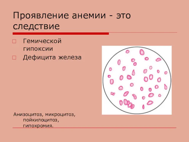 Проявление анемии - это следствие Гемической гипоксии Дефицита железа Анизоцитоз, микроцитоз, пойкилоцитоз, гипохромия.