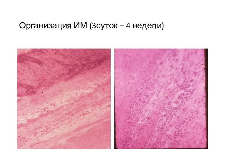 Организация ИМ (3суток – 4 недели)