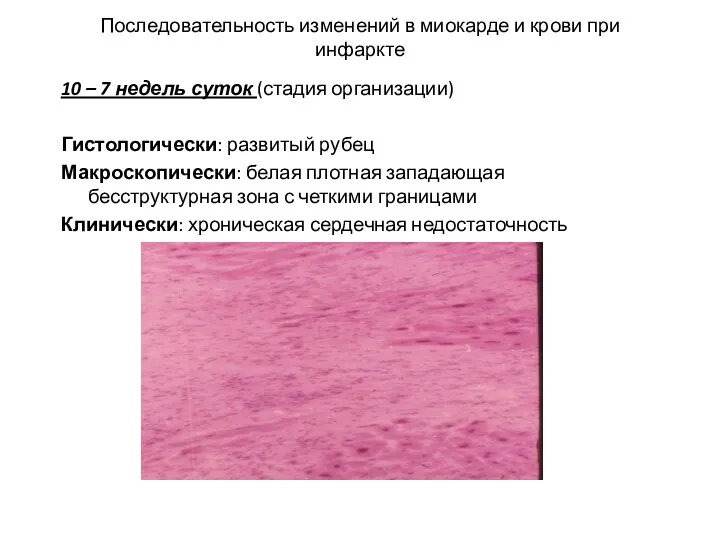 Последовательность изменений в миокарде и крови при инфаркте 10 –