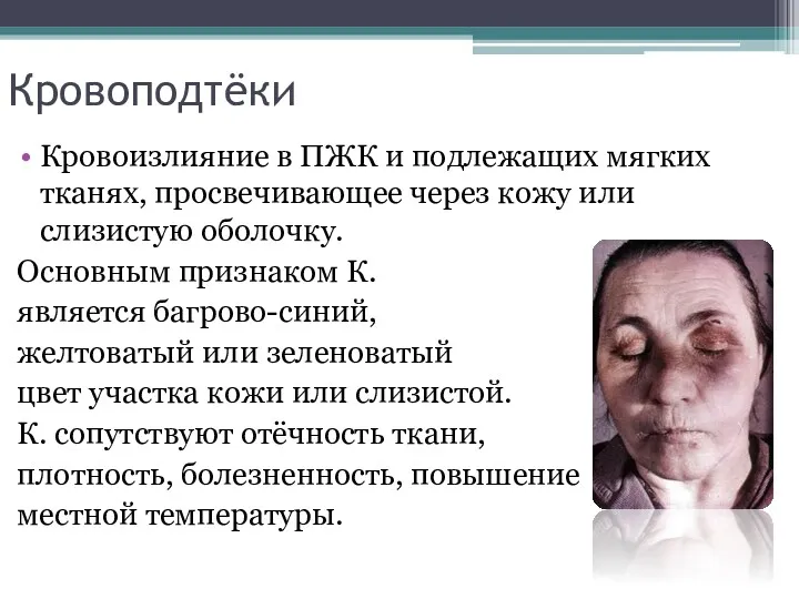 Кровоподтёки Кровоизлияние в ПЖК и подлежащих мягких тканях, просвечивающее через