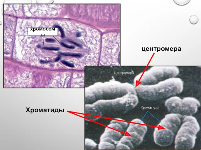 хромосомы центромера Хроматиды