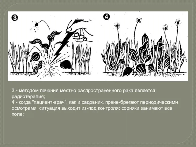 3 - методом лечения местно распространенного рака является радиотерапия; 4