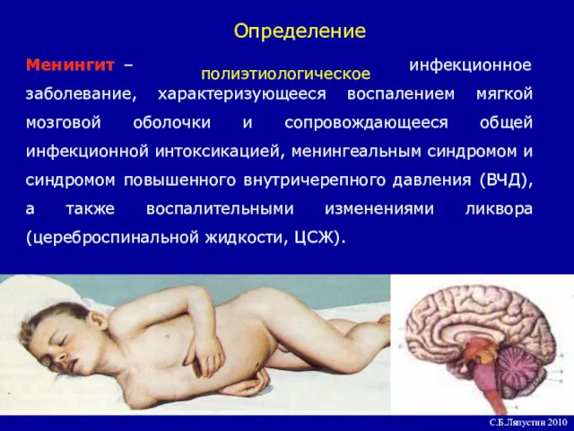 Менингит – инфекционное заболевание, характеризующееся воспалением мягкой мозговой оболочки и сопровождающееся общей инфекционной