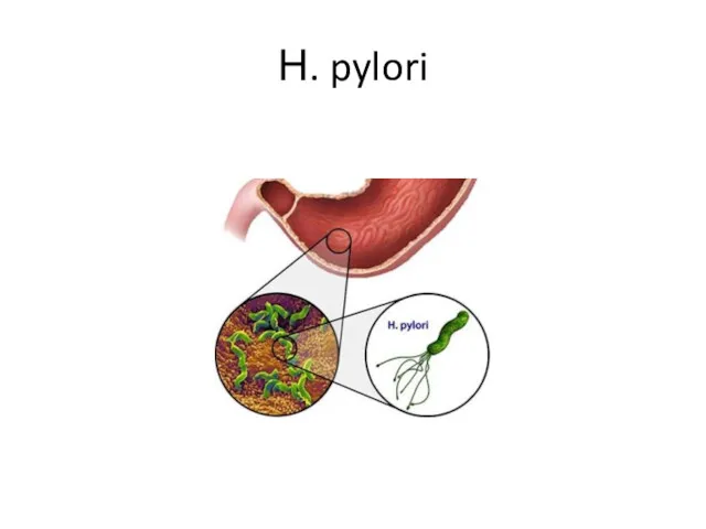 Н. pylori