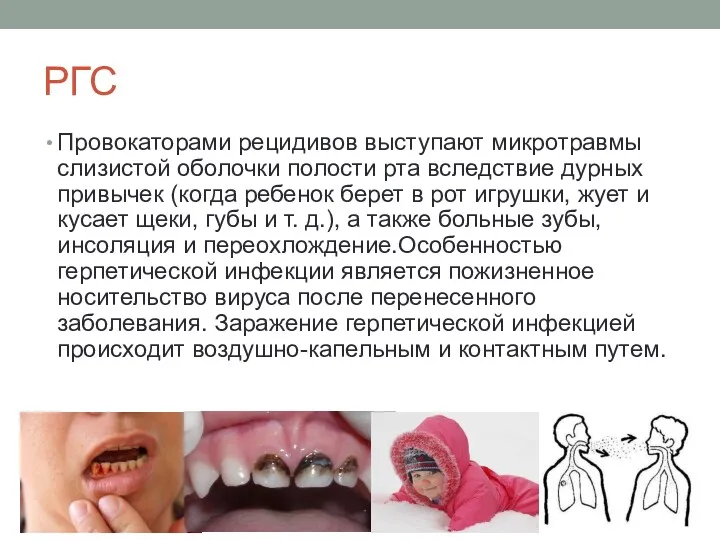 РГС Провокаторами рецидивов выступают микротравмы слизистой оболочки полости рта вследствие