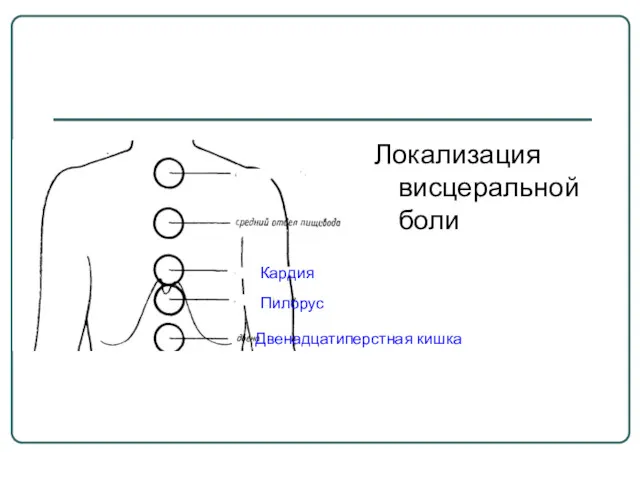 Локализация висцеральной боли Кардия Пилорус Двенадцатиперстная кишка