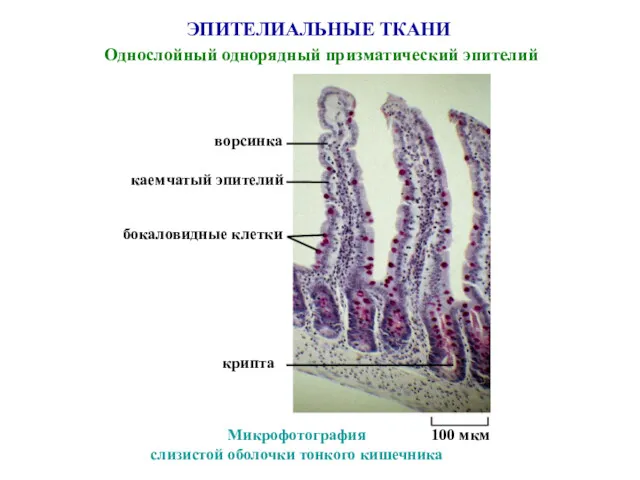 ЭПИТЕЛИАЛЬНЫЕ ТКАНИ Однослойный однорядный призматический эпителий ворсинка Микрофотография слизистой оболочки