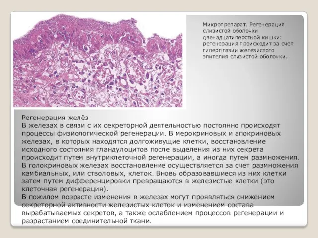 Регенерация желёз В железах в связи с их секреторной деятельностью постоянно происходят процессы