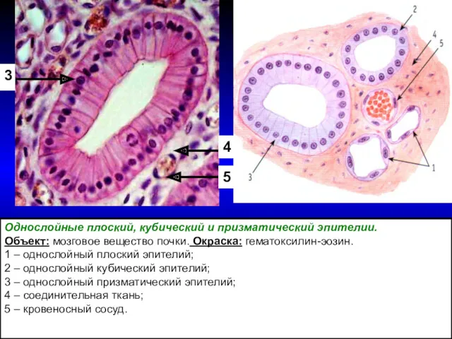 3 4 5 Однослойные плоский, кубический и призматический эпителии. Объект: