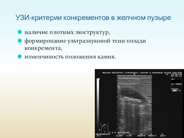 УЗИ-критерии конкрементов в желчном пузыре наличие плотных эхоструктур, формирование ультразвуковой тени позади конкремента, изменчивость положения камня.