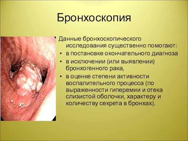 Бронхоскопия Данные бронхоскопического исследования существенно помогают: в постановке окончательного диагноза