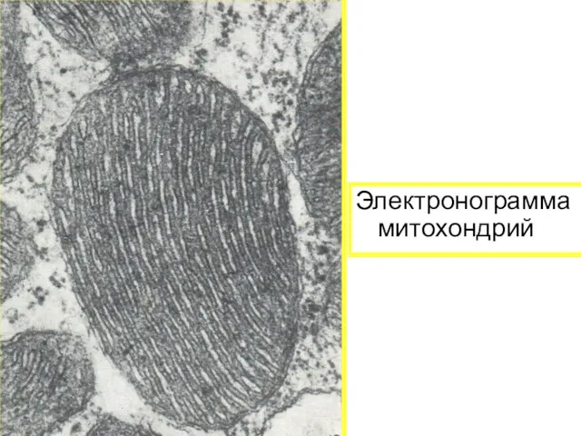 Электронограмма митохондрий
