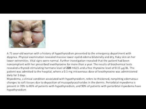 A 71-year-old woman with a history of hypothyroidism presented to