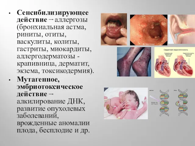 Сенсибилизирующее действие аллергозы (бронхиальная астма, риниты, отиты, васкулиты, колиты, гастриты,