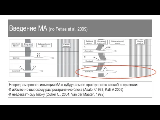 Введение МА (по Fettes et al. 2009) Непреднамеренная инъекция МА