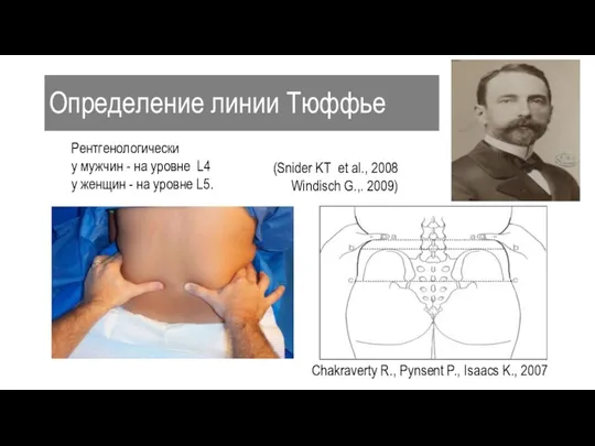 Определение линии Тюффье Chakraverty R., Pynsent P., Isaacs K., 2007