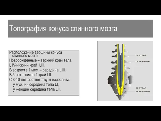 Топография конуса спинного мозга Расположение вершины конуса спинного мозга: Новорожденные