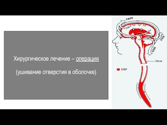 Хирургическое лечение – операция (ушивание отверстия в оболочке)