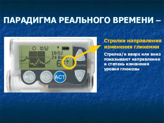 ПАРАДИГМА РЕАЛЬНОГО ВРЕМЕНИ – Стрелки направления изменения гликемии Стрелка/и вверх