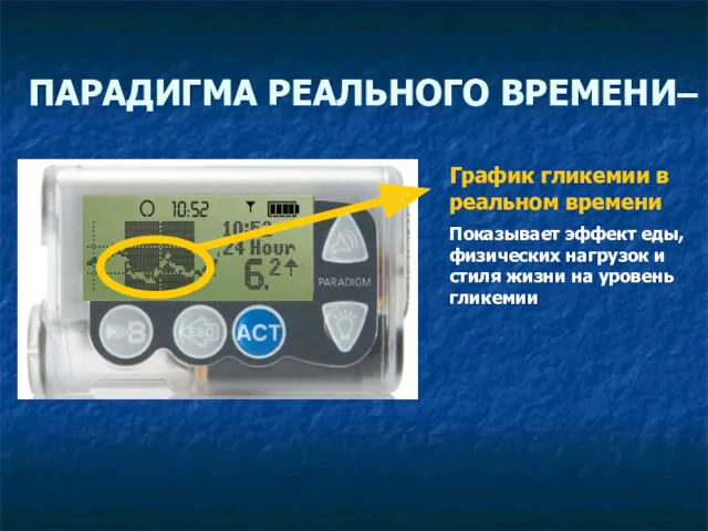 ПАРАДИГМА РЕАЛЬНОГО ВРЕМЕНИ– График гликемии в реальном времени Показывает эффект