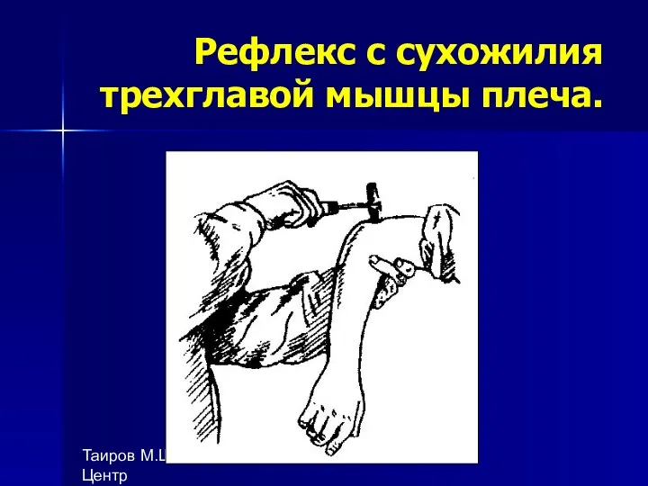 Таиров М.Ш., 1- Центр "подготовки ВОП", БухГосМИ Рефлекс с сухожилия трехглавой мышцы плеча.