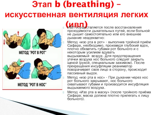 Этап b (breathing) – искусственная вентиляция легких (ивл) ИВЛ осуществляется