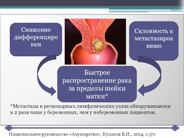 Снижение дифференцировки Склонность к метастазироавнию Быстрое распространение рака за пределы шейки матки* *Метастазы