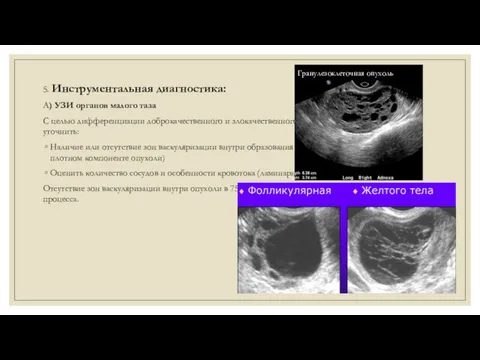 5. Инструментальная диагностика: А) УЗИ органов малого таза С целью