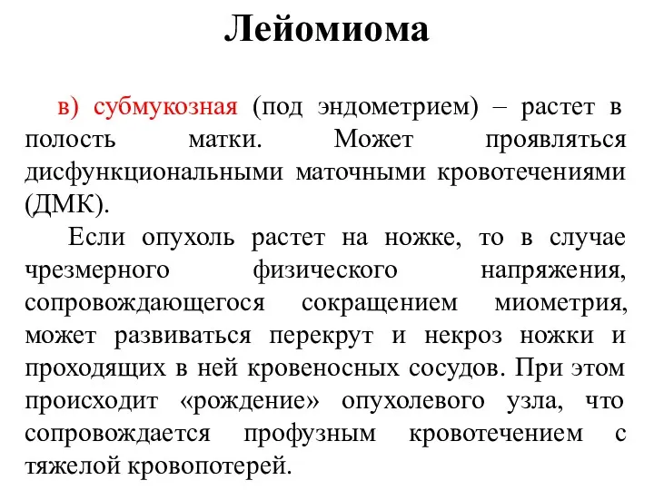 Лейомиома в) субмукозная (под эндометрием) – растет в полость матки.