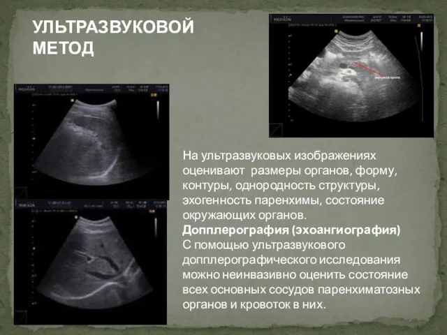 УЛЬТРАЗВУКОВОЙ МЕТОД На ультразвуковых изображениях оценивают размеры органов, форму, контуры,