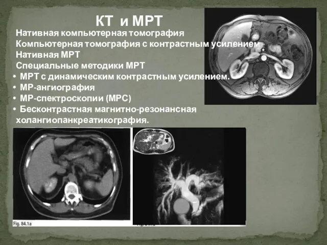 КТ и МРТ Нативная компьютерная томография Компьютерная томография с контрастным