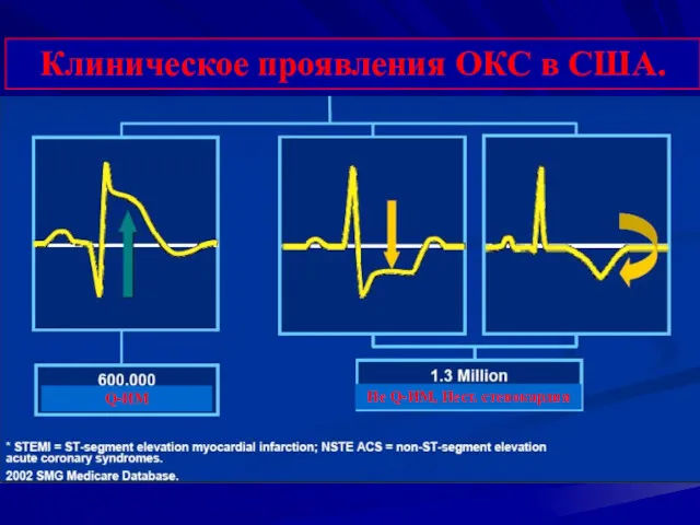 Клиническое проявления ОКС в США. Q-ИМ Не Q-ИМ, Нест. стенокардия