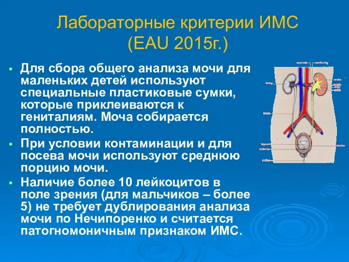 Лабораторные критерии ИМС (EAU 2015г.) Для сбора общего анализа мочи